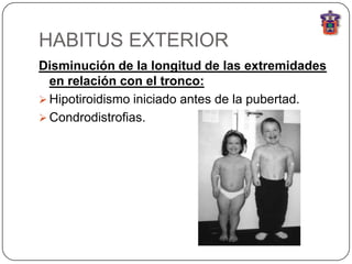 HABITUS EXTERIOR
Disminución de la longitud de las extremidades
  en relación con el tronco:
 Hipotiroidismo iniciado antes de la pubertad.
 Condrodistrofias.
 