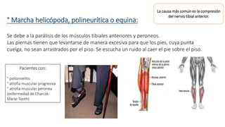 ° Marcha helicópoda, polineurítica o equina: 
Se debe a la parálisis de los músculos tibiales anteriores y peroneos. 
Las piernas tienen que levantarse de manera excesiva para que los pies, cuya punta 
cuelga, no sean arrastrados por el piso. Se escucha un ruido al caer el pie sobre el piso. 
Pacientes con: 
° poliomielitis 
° atrofia muscular progresiva 
° atrofia muscular peronea 
(enfermedad de Charcot- 
Marie-Tooth) 
La causa más común es la compresión 
del nervio tibial anterior. 
 