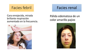 Facies renal 
Cara enrojecida, mirada 
brillante respiración 
aumentada en la frecuencia. 
Pálida edematosa de un 
color amarillo pajizo 
Facies febril 
 