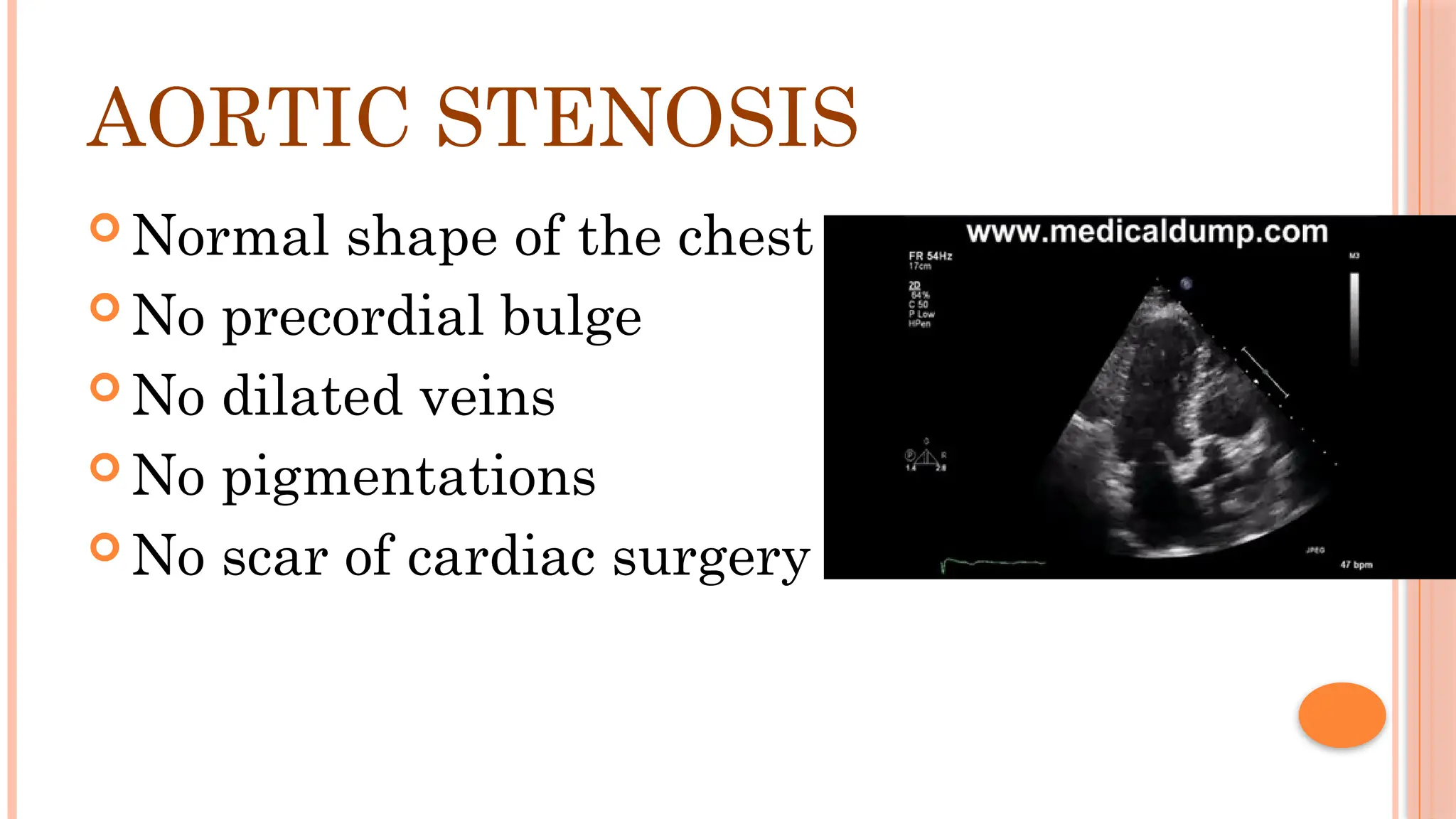 cardiac examination Inspection and palpation.pptx