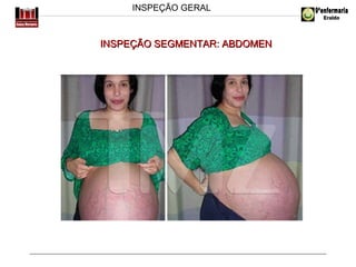 INSPEÇÃO GERAL

INSPEÇÃO SEGMENTAR: ABDOMEN

 