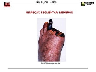 INSPEÇÃO GERAL

INSPEÇÃO SEGMENTAR: MEMBROS

HCUERJ-Cirurgia vascular

 