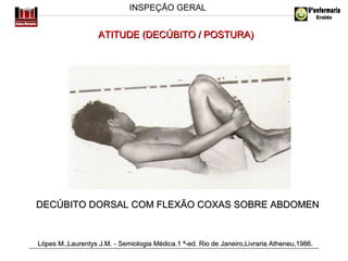 INSPEÇÃO GERAL

ATITUDE (DECÚBITO / POSTURA)

DECÚBITO DORSAL COM FLEXÃO COXAS SOBRE ABDOMEN

Lópes M.,Laurentys J.M. - Semiologia Médica.1 ª-ed. Rio de Janeiro,Livraria Atheneu,1986.

 