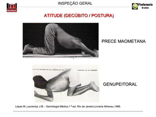 INSPEÇÃO GERAL

ATITUDE (DECÚBITO / POSTURA)

PRECE MAOMETANA

www.univali.com/semiologia

GENUPEITORAL

Lópes M.,Laurentys J.M. - Semiologia Médica.1 ª-ed. Rio de Janeiro,Livraria Atheneu,1986.

 