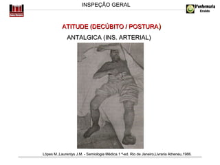 INSPEÇÃO GERAL

ATITUDE (DECÚBITO / POSTURA)
ANTALGICA (INS. ARTERIAL)

Lópes M.,Laurentys J.M. - Semiologia Médica.1 ª-ed. Rio de Janeiro,Livraria Atheneu,1986.

 
