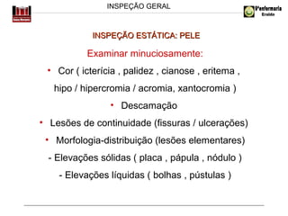 INSPEÇÃO GERAL

INSPEÇÃO ESTÁTICA: PELE

Examinar minuciosamente:
• Cor ( icterícia , palidez , cianose , eritema ,
hipo / hipercromia / acromia, xantocromia )
• Descamação
• Lesões de continuidade (fissuras / ulcerações)
• Morfologia-distribuição (lesões elementares)
- Elevações sólidas ( placa , pápula , nódulo )
- Elevações líquidas ( bolhas , pústulas )

 