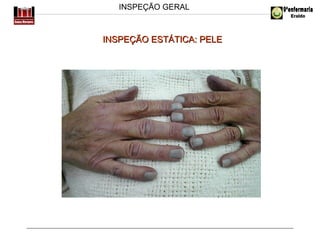 INSPEÇÃO GERAL

INSPEÇÃO ESTÁTICA: PELE

 