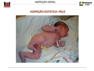 INSPEÇÃO GERAL

INSPEÇÃO ESTÁTICA: PELE

 