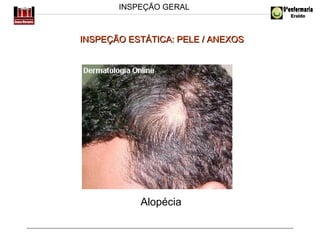 INSPEÇÃO GERAL

INSPEÇÃO ESTÁTICA: PELE / ANEXOS

Alopécia

 