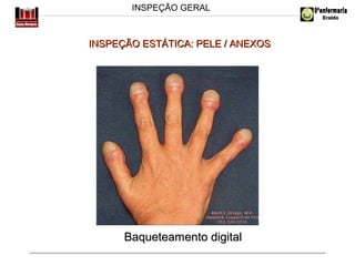 INSPEÇÃO GERAL

INSPEÇÃO ESTÁTICA: PELE / ANEXOS

Baqueteamento digital

 