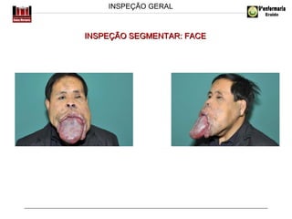 INSPEÇÃO GERAL

INSPEÇÃO SEGMENTAR: FACE

 
