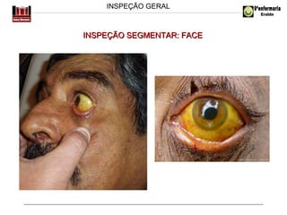 INSPEÇÃO GERAL

INSPEÇÃO SEGMENTAR: FACE

 