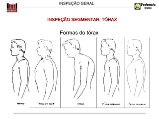 INSPEÇÃO GERAL

INSPEÇÃO SEGMENTAR: TÓRAX

Formas do tórax

 