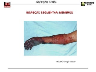 INSPEÇÃO GERAL

INSPEÇÃO SEGMENTAR: MEMBROS

HCUERJ-Cirurgia vascular

 
