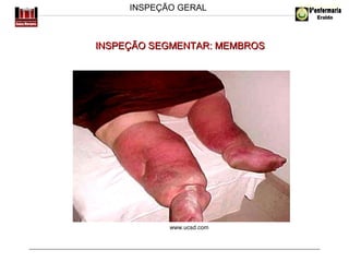 INSPEÇÃO GERAL

INSPEÇÃO SEGMENTAR: MEMBROS

www.ucsd.com

Prof. Lourdes

 