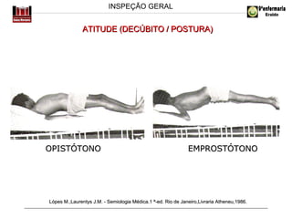 INSPEÇÃO GERAL

ATITUDE (DECÚBITO / POSTURA)

OPISTÓTONO

EMPROSTÓTONO

Lópes M.,Laurentys J.M. - Semiologia Médica.1 ª-ed. Rio de Janeiro,Livraria Atheneu,1986.

 