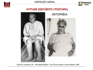 INSPEÇÃO GERAL

ATITUDE (DECÚBITO / POSTURA)
ORTOPNÉIA

Lópes M.,Laurentys J.M. - Semiologia Médica.1 ª-ed. Rio de Janeiro,Livraria Atheneu,1986.

 