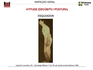 INSPEÇÃO GERAL

ATITUDE (DECÚBITO / POSTURA)
ESQUIADOR

Lópes M.,Laurentys J.M. - Semiologia Médica.1 ª-ed. Rio de Janeiro,Livraria Atheneu,1986.

 