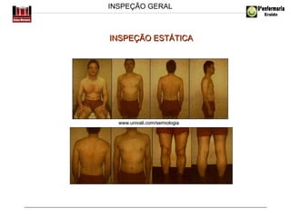 INSPEÇÃO GERAL

INSPEÇÃO ESTÁTICA

www.univali.com/semiologia

 