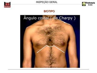 INSPEÇÃO GERAL

BIOTIPO

Ângulo costal ( de Charpy )

 