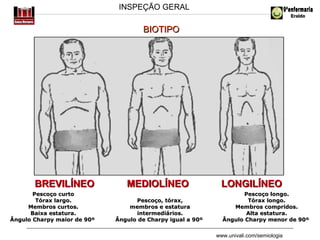 INSPEÇÃO GERAL

BIOTIPO

BREVILÍNEO
Pescoço curto
Tórax largo.
Membros curtos.
Baixa estatura.
Ângulo Charpy maior de 90º

MEDIOLÍNEO
Pescoço, tórax,
membros e estatura
intermediários.
Ângulo de Charpy igual a 90º

LONGILÍNEO
Pescoço longo.
Tórax longo.
Membros compridos.
Alta estatura.
Ângulo Charpy menor de 90º
www.univali.com/semiologia

 