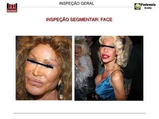 INSPEÇÃO GERAL

INSPEÇÃO SEGMENTAR: FACE

 
