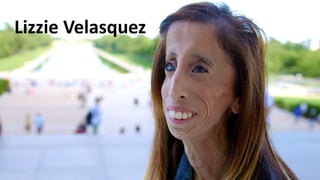 Lizzie Velasquez
 