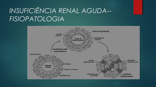 INSUFICIÊNCIA RENAL AGUDA--
FISIOPATOLOGIA
 