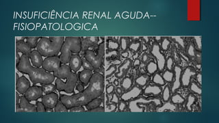 INSUFICIÊNCIA RENAL AGUDA--
FISIOPATOLOGICA
 