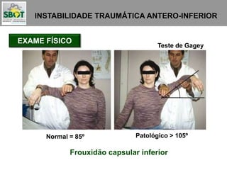 INSTABILIDADE TRAUMÁTICA ANTERO-INFERIOR
EXAME FÍSICO
Teste de Gagey
Normal = 85º Patológico > 105º
Frouxidão capsular inferior
 