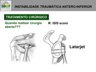 INSTABILIDADE TRAUMÁTICA ANTERO-INFERIOR
TRATAMENTO CIRÚRGICO
Quando realizar cirurgia
aberta???
R: ISIS score
Latarjet
 