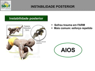INSTABILIDADE POSTERIOR
Instabilidade posterior
 Sofreu trauma em FARM
 Mais comum: esforço repetido
AIOS
 