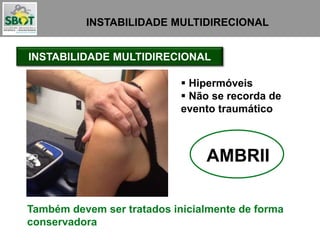 INSTABILIDADE MULTIDIRECIONAL
Também devem ser tratados inicialmente de forma
conservadora
INSTABILIDADE MULTIDIRECIONAL
 Hipermóveis
 Não se recorda de
evento traumático
AMBRII
 