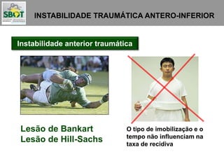 INSTABILIDADE TRAUMÁTICA ANTERO-INFERIOR
Instabilidade anterior traumática
Lesão de Bankart
Lesão de Hill-Sachs
O tipo de imobilização e o
tempo não influenciam na
taxa de recidiva
 