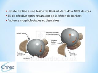 • Instabilité liée à une lésion de Bankart dans 40 à 100% des cas 
• 5% de récidive après réparation de la lésion de Bankart 
• Facteurs morphologiques et tissulaires 
 