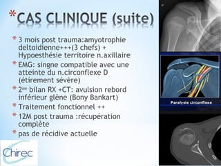 * 3 mois post trauma:amyotrophie 
deltoidienne+++(3 chefs) + 
Hypoesthésie territoire n.axillaire 
* EMG: singne compatible avec une 
atteinte du n.circonflexe D 
(étirement sévère) 
* 2ème bilan RX +CT: avulsion rebord 
inférieur glène (Bony Bankart) 
* Traitement fonctionnel ++ 
* 12M post trauma :récupération 
complète 
* pas de récidive actuelle 
 