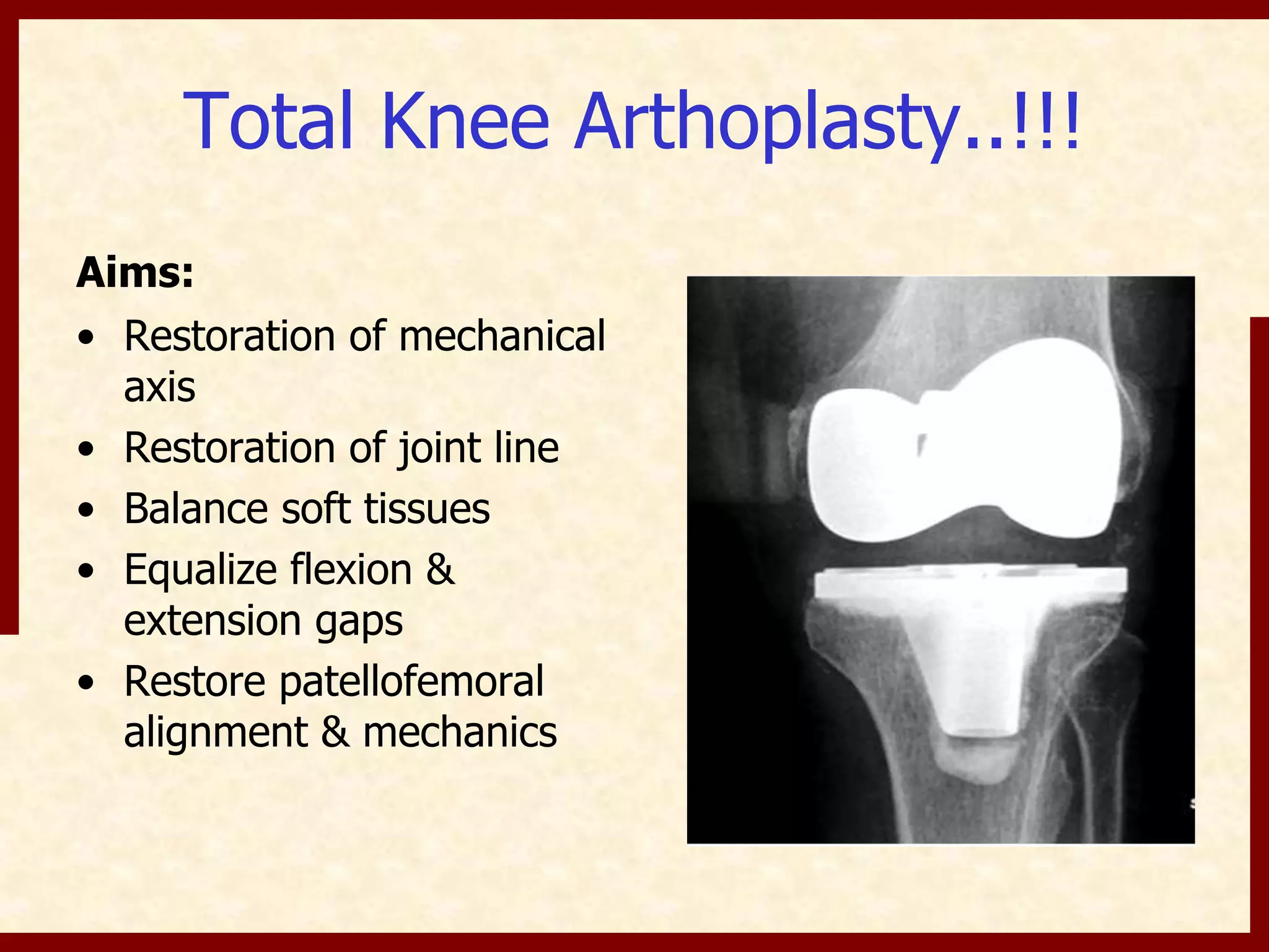 Instability in TKR | PPTX