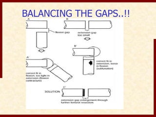 BALANCING THE GAPS..!! 
 