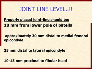 JOINT LINE LEVEL..!! 
Properly placed joint-line should be: 
10 mm from lower pole of patella 
approximately 30 mm distal to medial femoral 
epicondyle 
25 mm distal to lateral epicondyle 
10-15 mm proximal to fibular head 
 