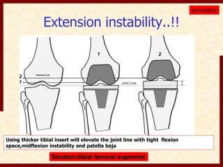 Extension instability..!! 
symmetric 
Using thicker tibial insert will elevate the joint line with tight flexion 
space,midflexion instability and patella baja 
Solution:distal femoral augments 
 