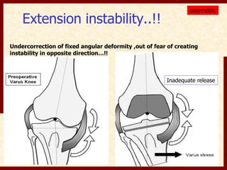 Extension instability..!! 
assymetric 
Undercorrection of fixed angular deformity ,out of fear of creating 
instability in opposite direction…!! 
Inadequate release 
 