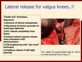 Lateral release for valgus knees..!! 
“Inside-out” technique.. 
Sequence: 
1.Removal of lateral osteophytes 
2.Placement of lamina spreader to 
assist gap tightness 
3.PCL release completely from 
femur 
4.Postero-lateral capsule release 
intra-articularly with 
electrocautery 
5.ITB lengthening with “pie-crust” 
technique 
6.Popliteus release if still tight 
laterally The depth of surgical blade kept at <5mm 
to avoid peroneal nerve injury..!! 
 