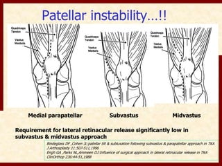 Patellar instability…!! 
Medial parapatellar Subvastus Midvastus 
Requirement for lateral retinacular release significantly low in 
subvastus & midvastus approach 
Bindeglass DF ,Cohen JL:patellar tilt & subluxation following subvastus & parapatellar approach in TKA 
J Arthosplasty 11:507-511,1996 
Engh GA ,Parks NL,Ammeen DJ:Influence of surgical approach in lateral retinacular release in TKA 
ClinOrthop 236:44-51,1988 
 