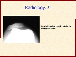 Radiology..!! 
Laterally subluxated patella in 
merchant view 
 