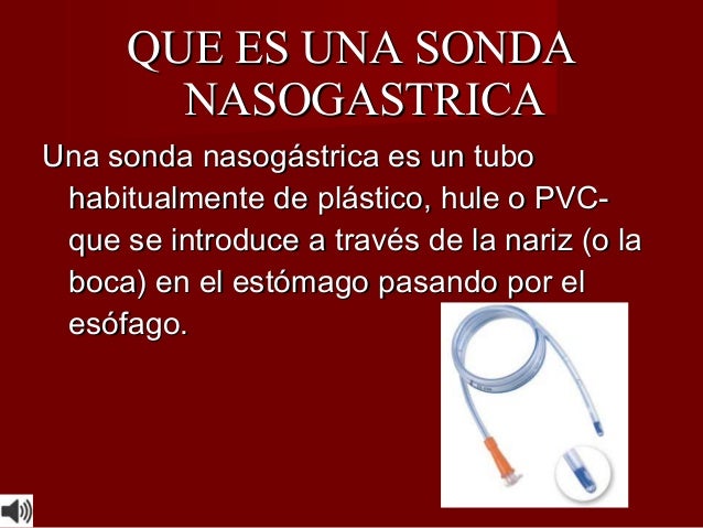 Material forex que es