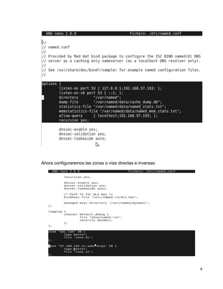 6
Ahora configuraremos las zonas o vías directas e inversas:
 