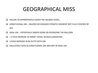 GEOGRAPHICAL MISS
 FAILURE TO APPROPRIATELY COVER THE INJURED VESSEL .
 LONGITUDINAL GM – INJURED OR DISEASED STENOTIC SEGMENT NOT FULLY COVERED BY
DES
 AXIAL GM : POTENTIALLY UNDER SIZING OR OVERSIZING THE BALLOON
 > 2 FOLD INCREASE IN TARGET VESSEL REVASCULARISATION
 3 FOLD INCREASE IN MI IN PTS WITH GM
 EXCLUSIVELY SEEN IN LONGITUDINAL GM AND NOT IN AXIAL GM
 