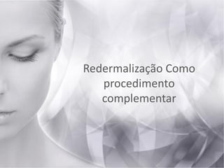 Redermalização Como
procedimento
complementar
28
 