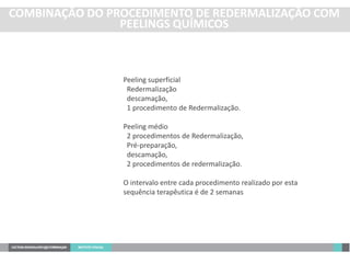 Peeling superficial
Redermalização
descamação,
1 procedimento de Redermalização.
Peeling médio
2 procedimentos de Redermalização,
Pré-preparação,
descamação,
2 procedimentos de redermalização.
O intervalo entre cada procedimento realizado por esta
sequência terapêutica é de 2 semanas
COMBINAÇÃO DO PROCEDIMENTO DE REDERMALIZAÇÃO COM
PEELINGS QUÍMICOS
 