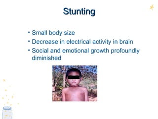 Stunting Small body size Decrease in electrical activity in brain Social and emotional growth profoundly diminished 